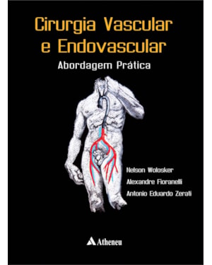 Cirurgia vascular e endovascular: Abordagem prática