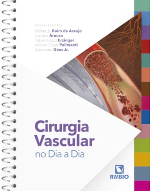 Cirurgia vascular no dia a dia