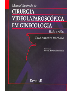 CIRURGIA VIDEOLAPAROSCÓPICA EM GINECOLOGIA