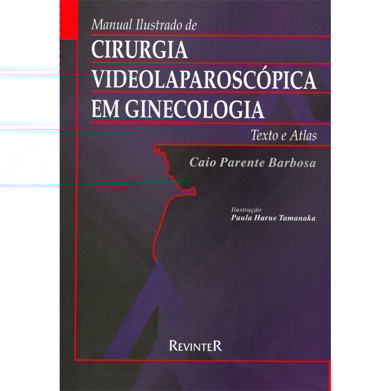 CIRURGIA VIDEOLAPAROSCÓPICA EM GINECOLOGIA