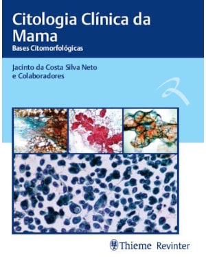 Citologia clínica da mama: bases citomorfológicas