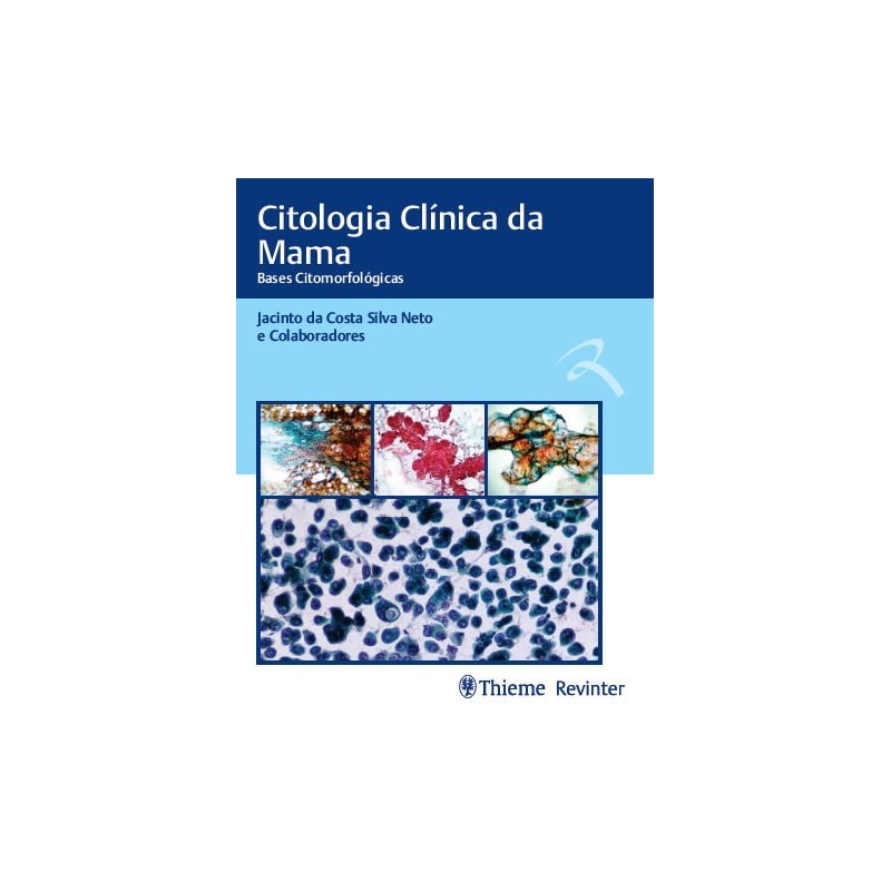 CITOLOGIA CLÍNICA DA MAMA: BASES CITOMORFOLÓGICAS