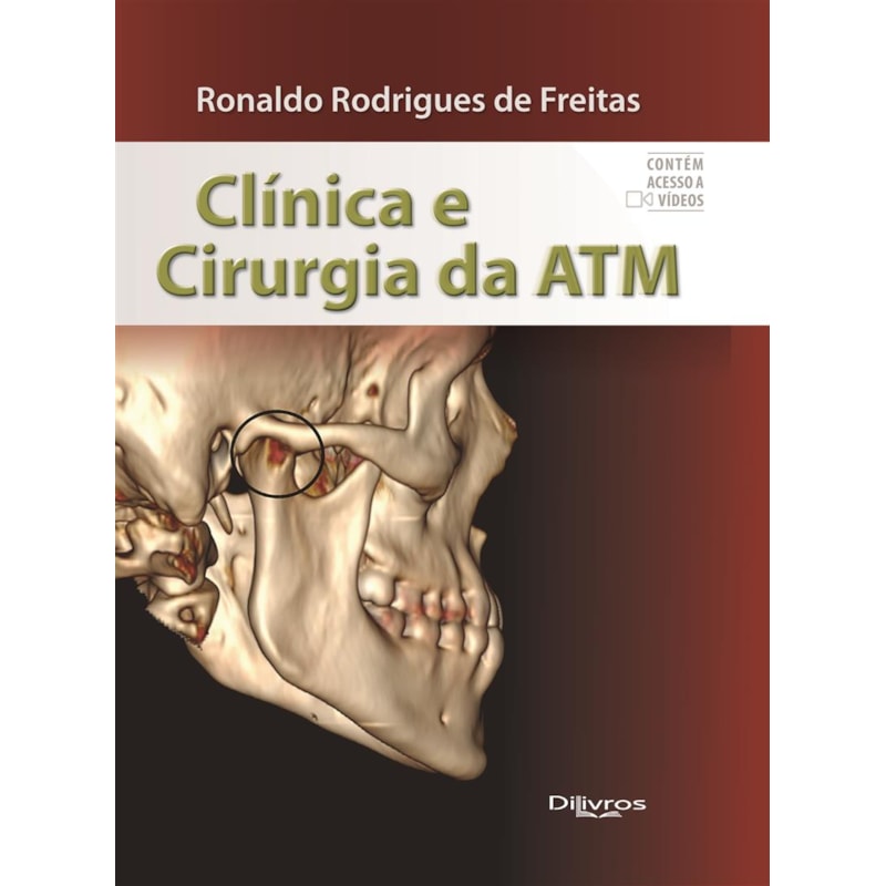 CLÍNICA E CIRURGIA DA ATM