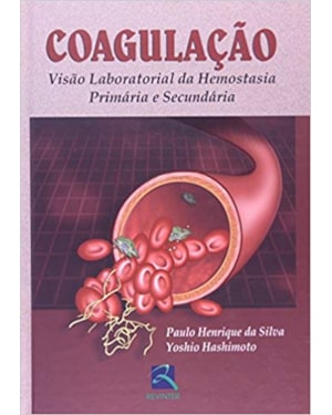 Coagulação: visão laboratorial da hemostasia primária e secundária