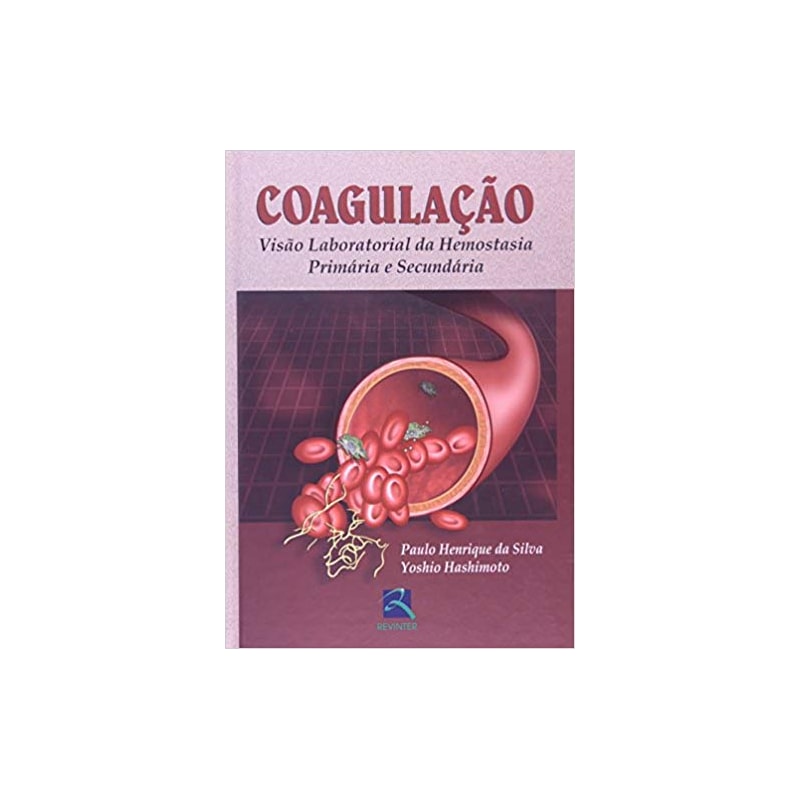 COAGULAÇÃO: VISÃO LABORATORIAL DA HEMOSTASIA PRIMÁRIA E SECUNDÁRIA