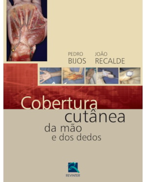 Cobertura cutânea da mão e dos dedos