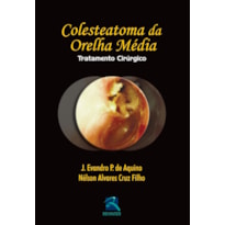 COLESTEATOMA DA ORELHA MÉDIA: TRATATAMENTO CIRÚRGICO