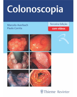 Colonoscopia