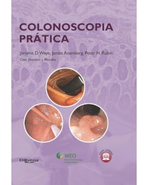 COLONOSCOPIA PRATICA - 1