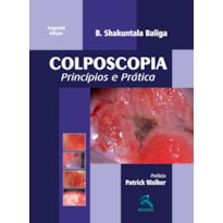 COLPOSCOPIA: PRINCÍPIOS E PRÁTICA