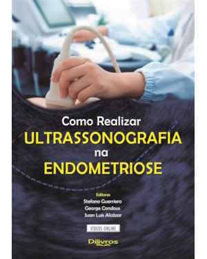 COMO REALIZAR ULTRASSONOGRAFIA NA ENDOMETRIOSE