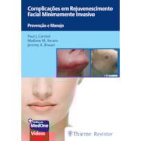 COMPLICAÇÕES EM REJUVENESCIMENTO FACIAL MINIMAMENTE INVASIVO: PREVENÇÃO E MANEJO