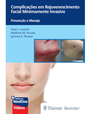 Complicações em rejuvenescimento facial minimamente invasivo: prevenção e manejo
