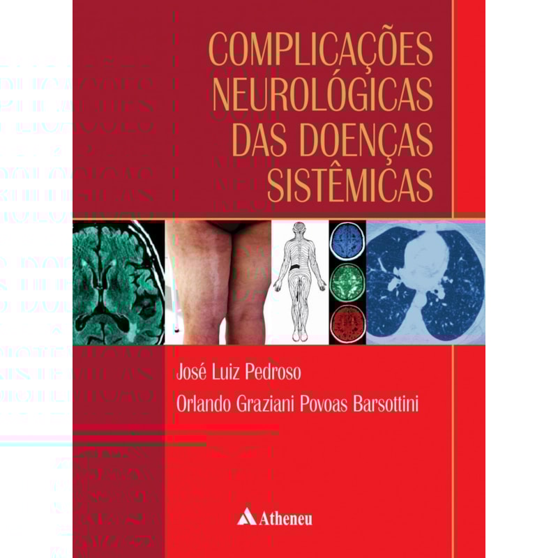 COMPLICAÇÕES NEUROLÓGICAS DAS DOENÇAS SISTÊMICAS
