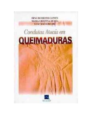 CONDUTAS ATUAIS EM QUEIMADURAS