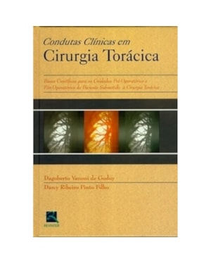 CONDUTAS CLÍNICAS EM CIRURGIA TORÁCICA