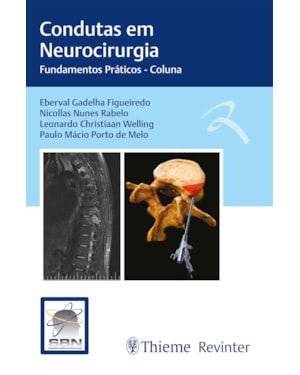 Condutas em Neurocirurgia: Fundamentos Práticos - Coluna