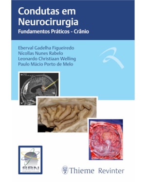 Condutas em Neurocirurgia: Fundamentos Práticos - Crânio