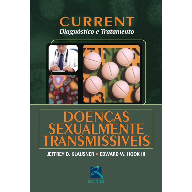 CURRENT DOENÇAS SEXUALMENTE TRANSMISSÍVEIS: DIAGNÓSTICO E TRATAMENTO