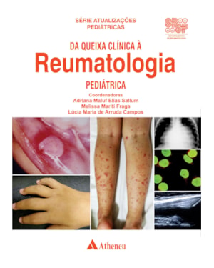 Da queixa clínica à reumatologia pediátrica