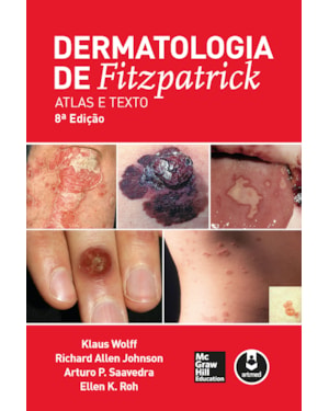 DERMATOLOGIA DE FITZPATRICK: ATLAS E TEXTO