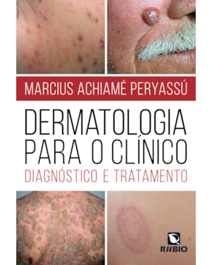 Dermatologia para o clínico: Diagnóstico e tratamento