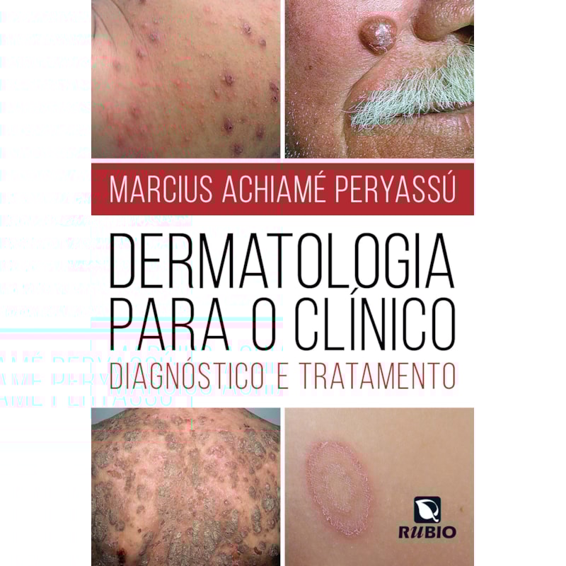 DERMATOLOGIA PARA O CLÍNICO: DIAGNÓSTICO E TRATAMENTO