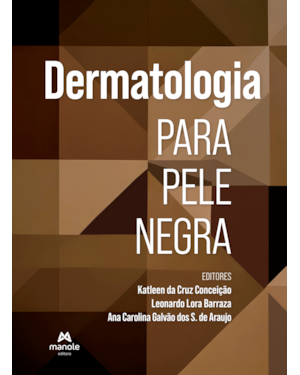 Dermatologia para pele negra