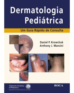 DERMATOLOGIA PEDIATRICA - UM GUIA RAPIDO DE CONSULTA