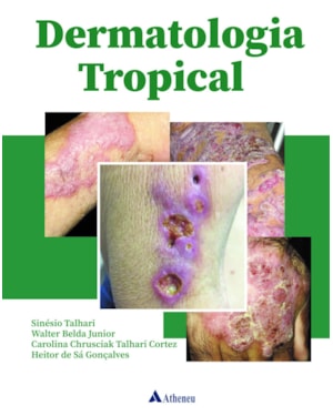 Dermatologia tropical