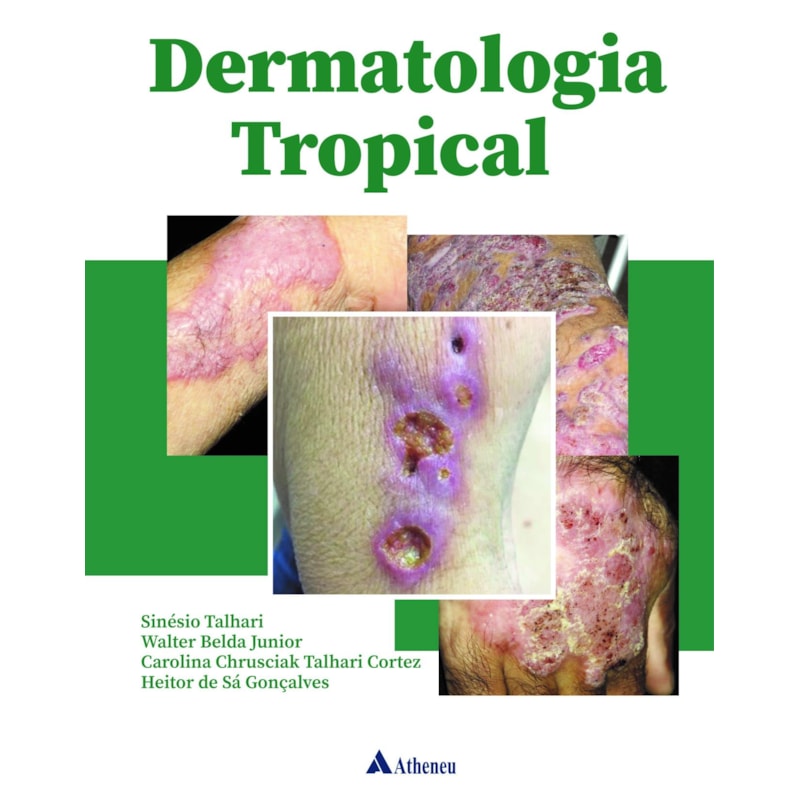 DERMATOLOGIA TROPICAL