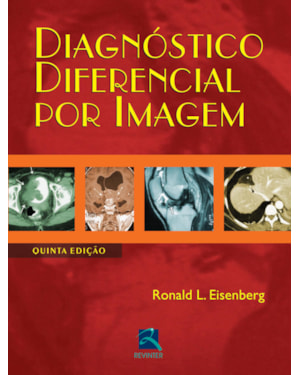Diagnóstico diferencial por imagem