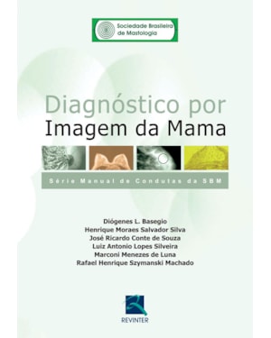Diagnóstico por imagem da mama