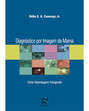 Diagnóstico por imagem da mama: uma abordagem integrada