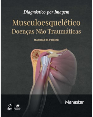 DIAGNÓSTICO POR IMAGEM - MUSCULOESQUELÉTICO - DOENÇAS NÃO TRAUMÁTICAS