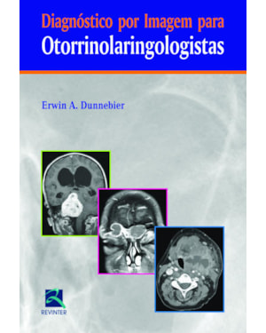 Diagnóstico por imagem para otorrinolaringologistas