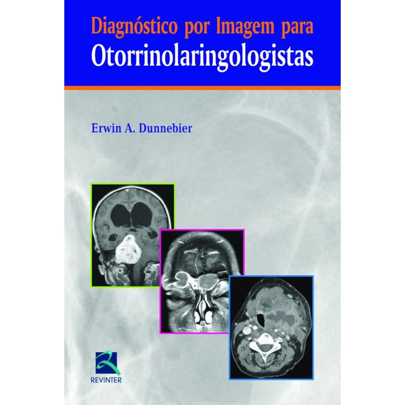 DIAGNÓSTICO POR IMAGEM PARA OTORRINOLARINGOLOGISTAS
