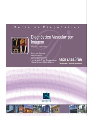 Diagnóstico vascular por imagem: módulo vascular