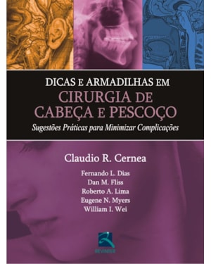 Dicas e armadilhas em cirurgia de cabeça e pescoço: sugestões práticas para minimizar complicações