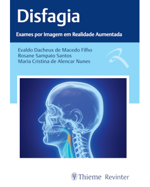 Disfagia: exames por imagem em realidade aumentada