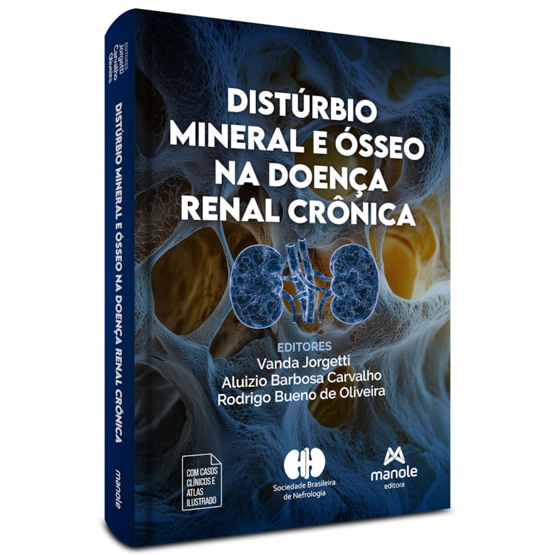 DISTÚRBIO MINERAL E ÓSSEO NA DOENÇA RENAL CRÔNICA
