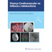 DOENÇA CEREBROVASCULAR NA INFÂNCIA E ADOLESCÊNCIA