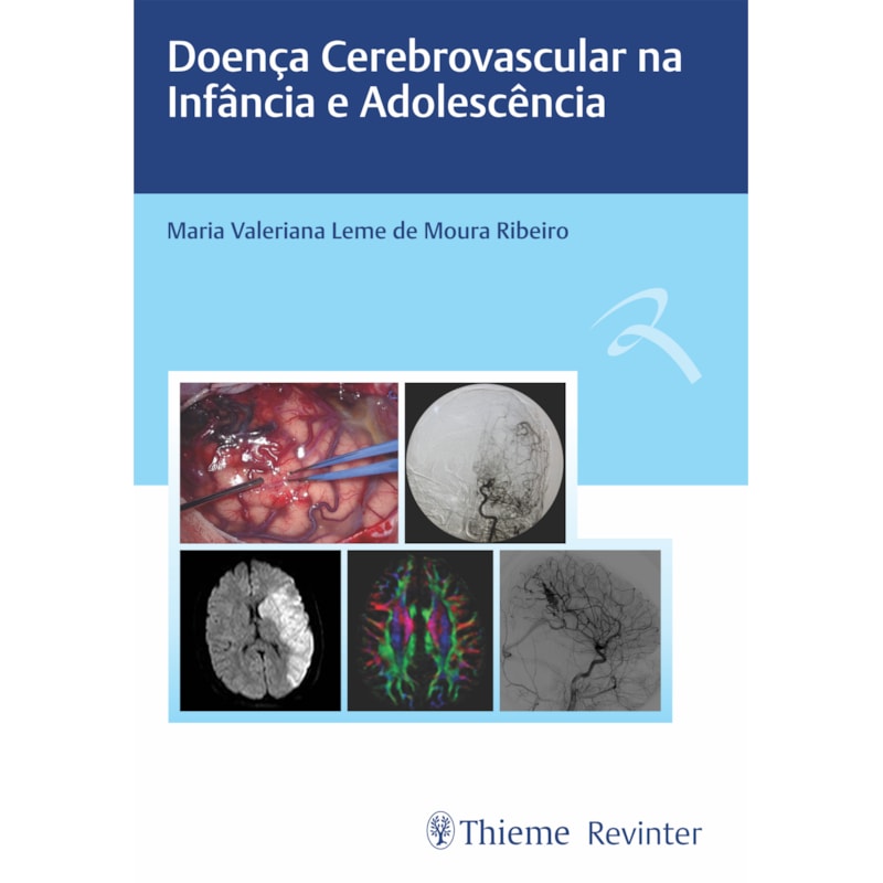 DOENÇA CEREBROVASCULAR NA INFÂNCIA E ADOLESCÊNCIA