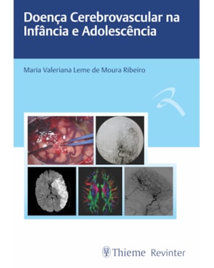 Doença cerebrovascular na infância e adolescência