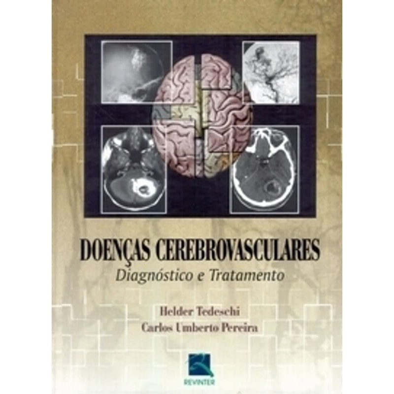 DOENÇAS CEREBROVASCULARES: DIAGNÓSTICO E TRATAMENTO