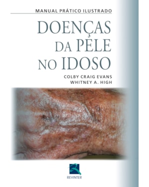 Doenças da pele no idoso: manual prático ilustrado