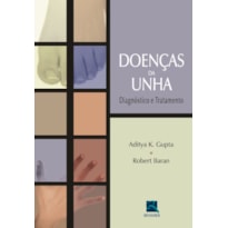 DOENÇAS DA UNHA: DIAGNÓSTICO E TRATAMENTO