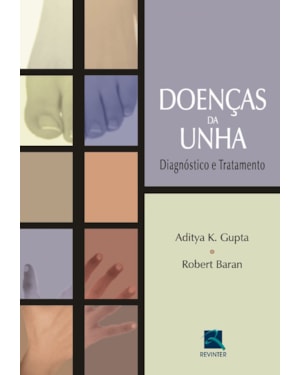 Doenças da unha: diagnóstico e tratamento