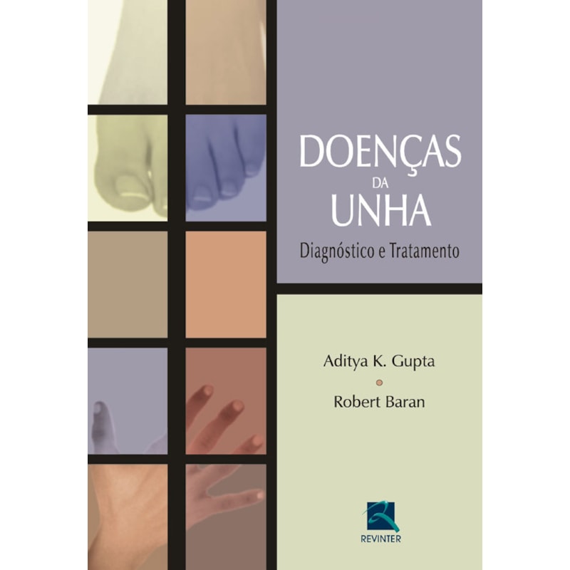 DOENÇAS DA UNHA: DIAGNÓSTICO E TRATAMENTO