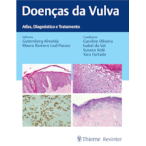 DOENÇAS DA VULVA: ATLAS, DIAGNÓSTICO E TRATAMENTO